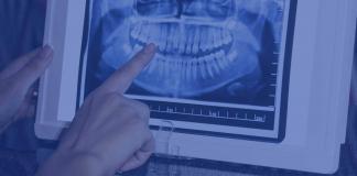 consulenza radiologica odontoiatrica online