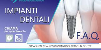 impianti dentali roma studio odontoiatrico dominici